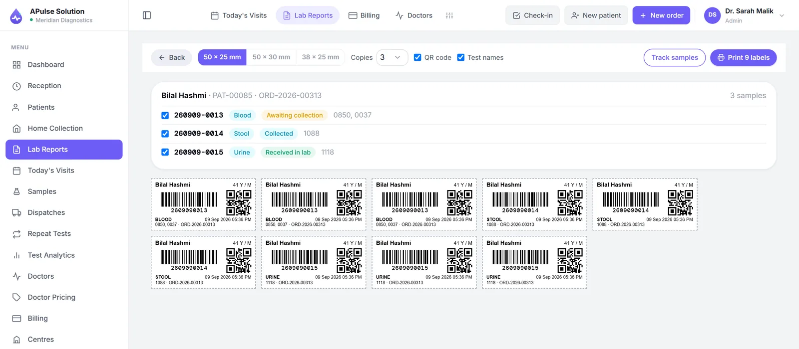 Tube label printing in A Pulse Solution: label size chosen between 50 by 25, 50 by 30 and 38 by 25 millimetres, three copies each, and a grid of labels carrying the patient name, age and sex, a barcode with the sample number in digits, a QR code, the sample type, the time and the test codes